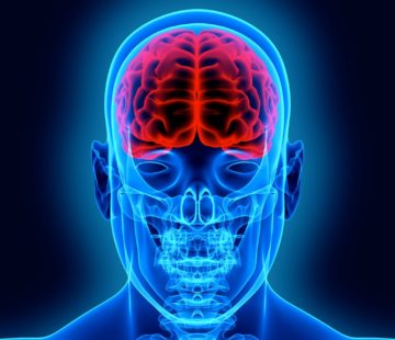 Car accidents 3rd leading cause of brain injuries in the U.S.